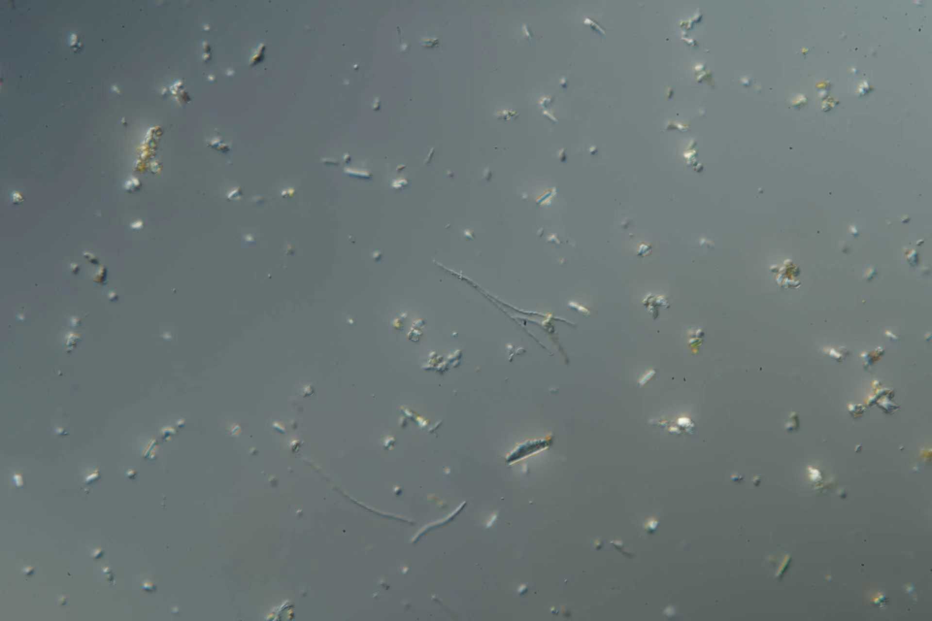 e5cddbcc9c954903dcf9a8885d9da63a