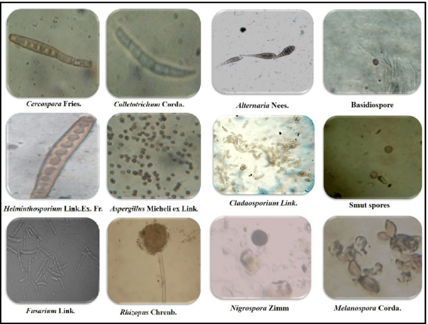 Photographs-of-identified-pathogenic-fungal-spore-types-from-guava-orchard